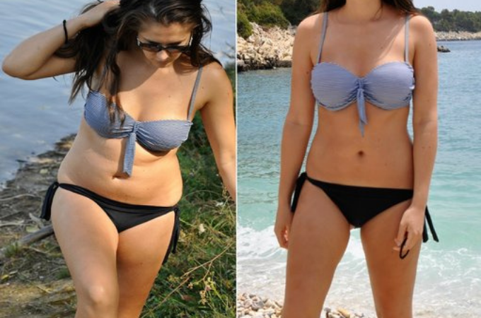 before and after (2)