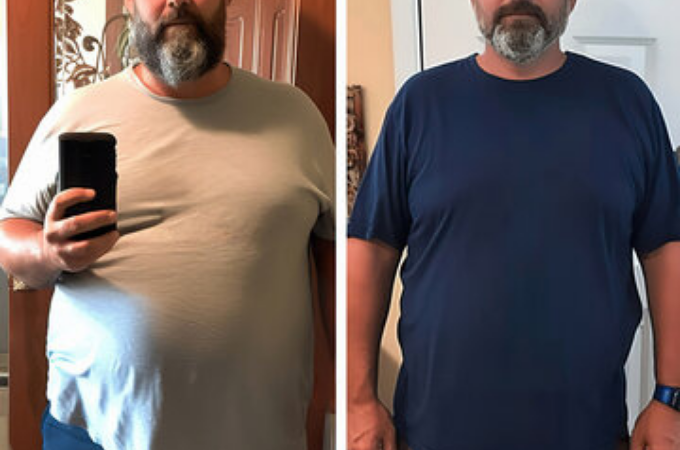 before and after (7)